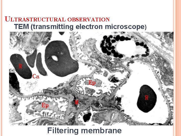 ULTRASTRUCTURAL OBSERVATION TEM (transmitting electron microscope) Filtering membrane 