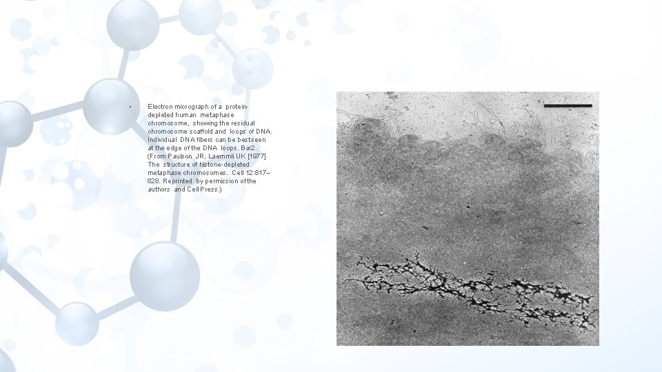  • Electron micrograph of a proteindepleted human metaphase chromosome, showing the residual chromosome