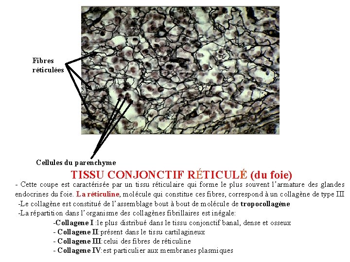 Fibres réticulées Cellules du parenchyme TISSU CONJONCTIF RÉTICULÉ (du foie) - Cette coupe est