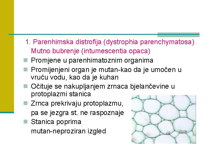 1. Parenhimska distrofija (dystrophia parenchymatosa) Mutno bubrenje (intumescentia opaca) n Promjene u parenhimatoznim organima