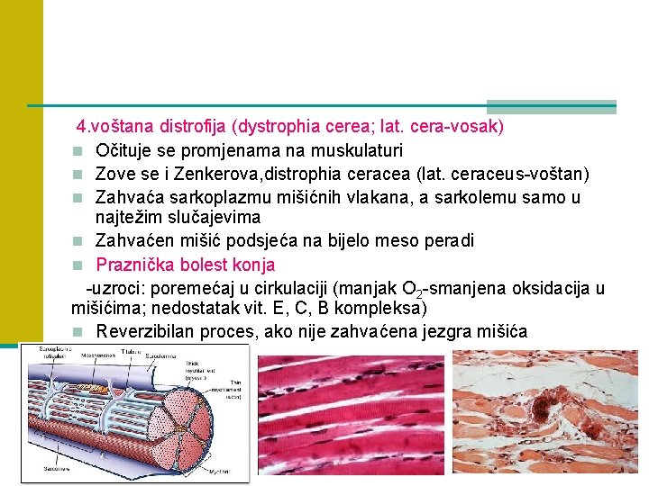 4. voštana distrofija (dystrophia cerea; lat. cera-vosak) n Očituje se promjenama na muskulaturi n