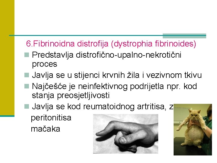 6. Fibrinoidna distrofija (dystrophia fibrinoides) n Predstavlja distrofično-upalno-nekrotični proces n Javlja se u stijenci