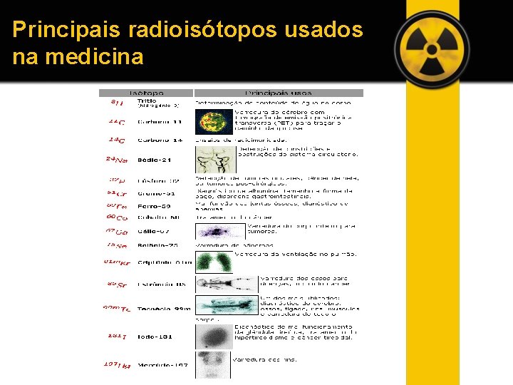 Principais radioisótopos usados na medicina 