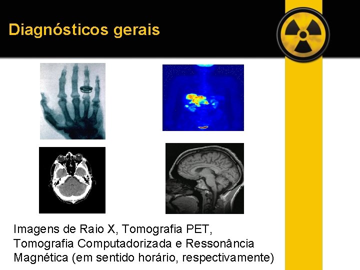 Diagnósticos gerais Imagens de Raio X, Tomografia PET, Tomografia Computadorizada e Ressonância Magnética (em