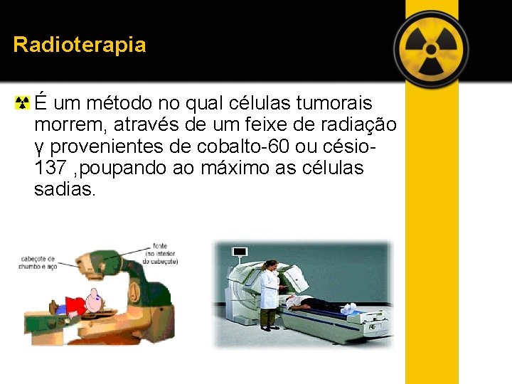 Radioterapia É um método no qual células tumorais morrem, através de um feixe de