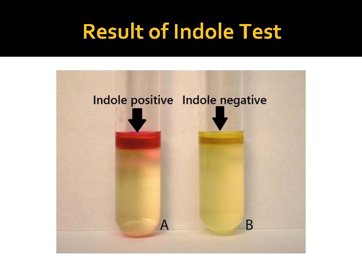Result of Indole Test 