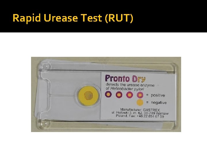 Rapid Urease Test (RUT) 