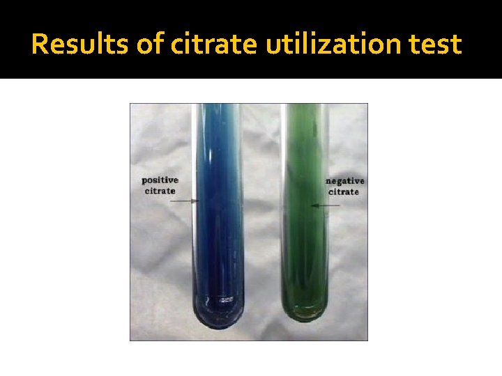 Results of citrate utilization test 