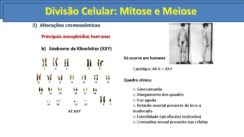 Divisão. Celular: Mitoseeee. Meiose Divisão Celular: Mitose Meiose 3) Alterações cromossômicas Principais aneuploidias humanas