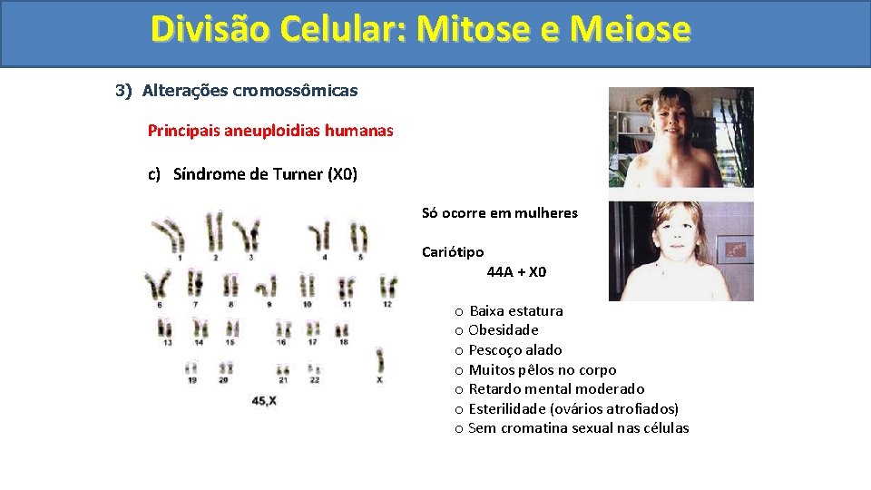 Divisão. Celular: Mitoseee. Meiose 3) Alterações cromossômicas Principais aneuploidias humanas c) Síndrome de Turner