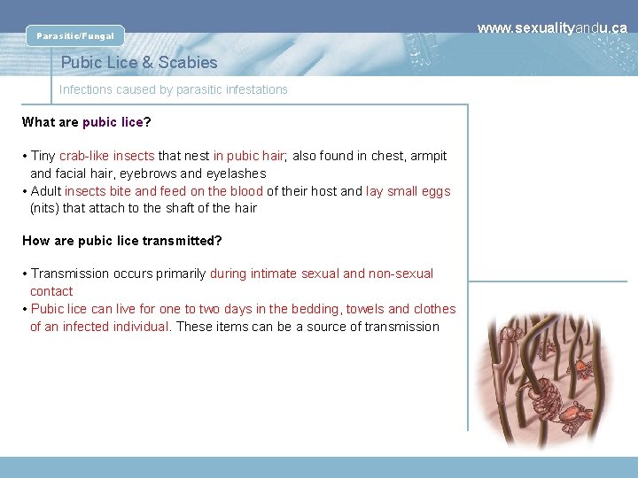 Parasitic/Fungal Pubic Lice & Scabies Infections caused by parasitic infestations What are pubic lice?