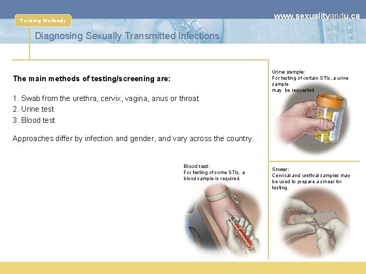 www. sexualityandu. ca Testing Methods Diagnosing Sexually Transmitted Infections Urine sample: For testing of