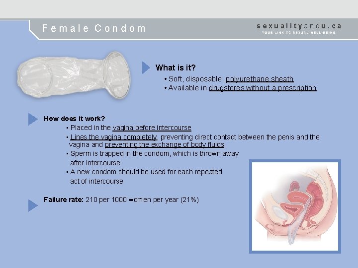 sexualityandu. ca Female Condom What is it? • Soft, disposable, polyurethane sheath • Available