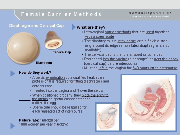 Female Barrier Methods Diaphragm and Cervical Cap Diaphragm What are they? • Intravaginal barrier