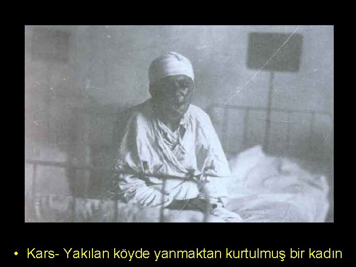  • Kars- Yakılan köyde yanmaktan kurtulmuş bir kadın 