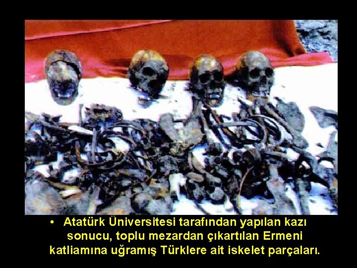  • Atatürk Üniversitesi tarafından yapılan kazı sonucu, toplu mezardan çıkartılan Ermeni katliamına uğramış