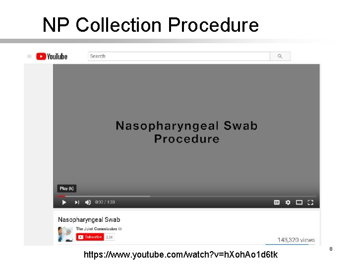 NP Collection Procedure https: //www. youtube. com/watch? v=h. Xoh. Ao 1 d 6 tk