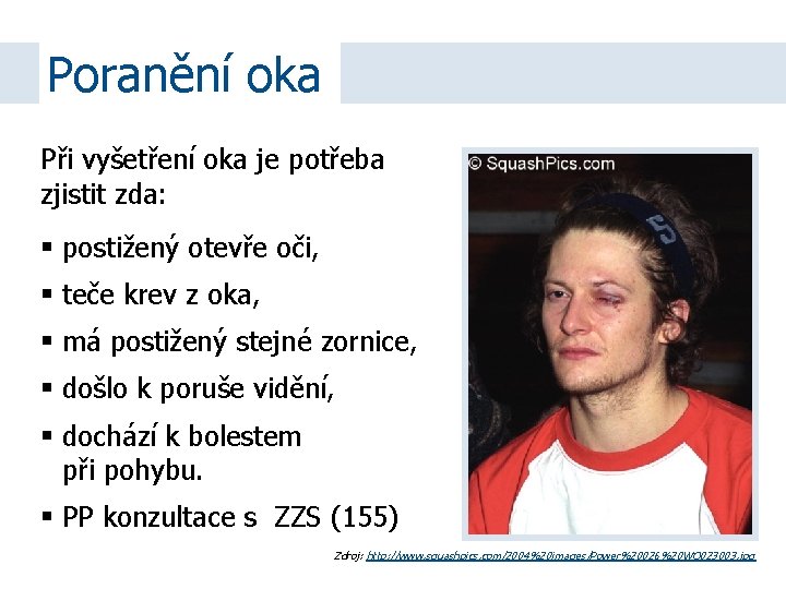 Poranění oka Při vyšetření oka je potřeba zjistit zda: postižený otevře oči, teče krev