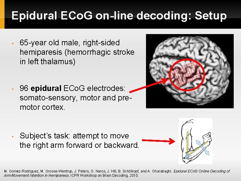 Epidural ECo. G on-line decoding: Setup • 65 -year old male, right-sided hemiparesis (hemorrhagic Epidural ECo. G on-line decoding: Setup • 65 -year old male, right-sided hemiparesis (hemorrhagic