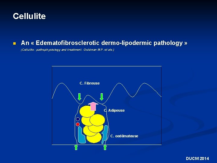 Cellulite n An « Edematofibrosclerotic dermo-lipodermic pathology » (Cellulite : pathophysiology and treatment. Goldman