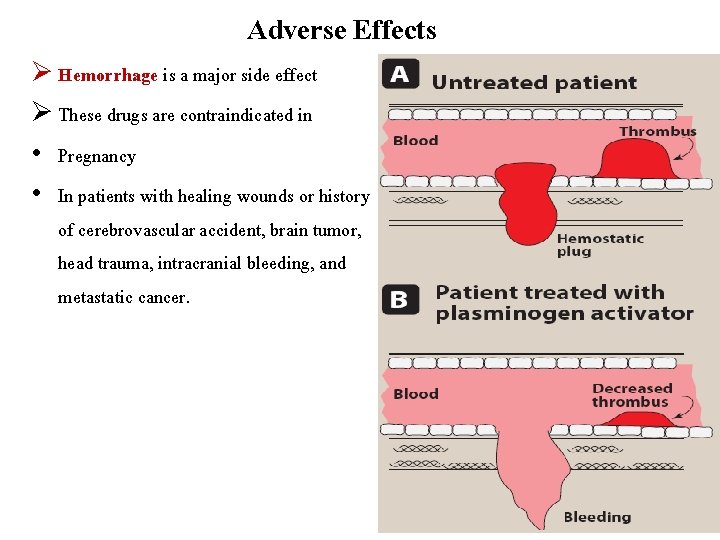 Adverse Effects Ø Hemorrhage is a major side effect Ø These drugs are contraindicated