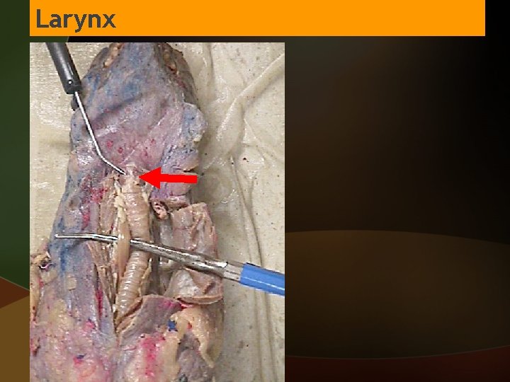 Larynx 