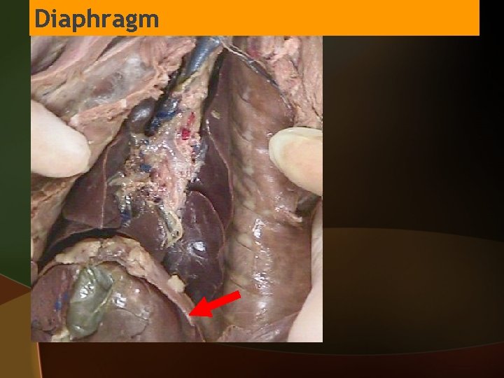Diaphragm 