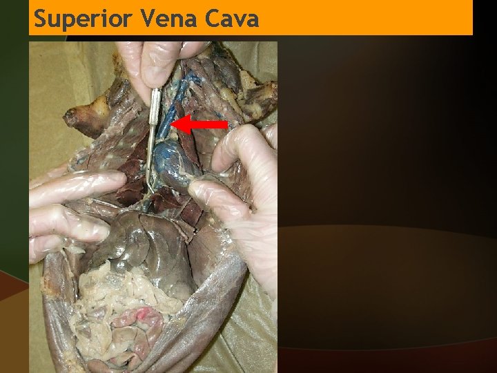 Superior Vena Cava 