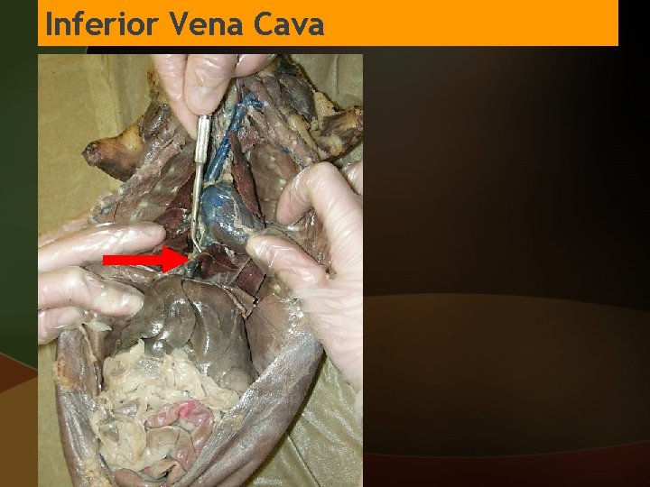 Inferior Vena Cava 