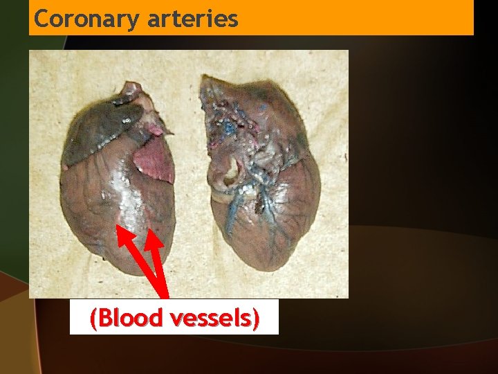 Coronary arteries (Blood vessels) 