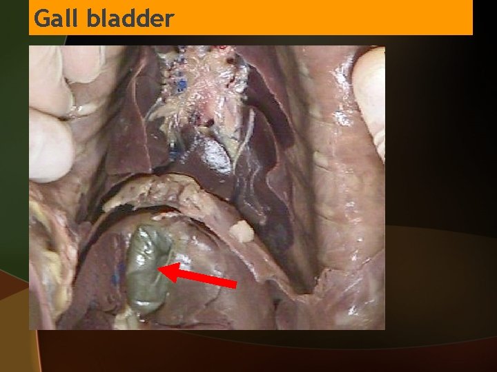 Gall bladder 