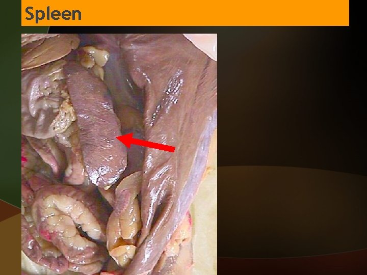 Spleen 