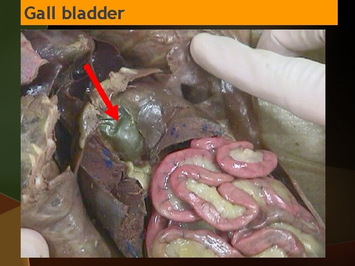 Gall bladder 