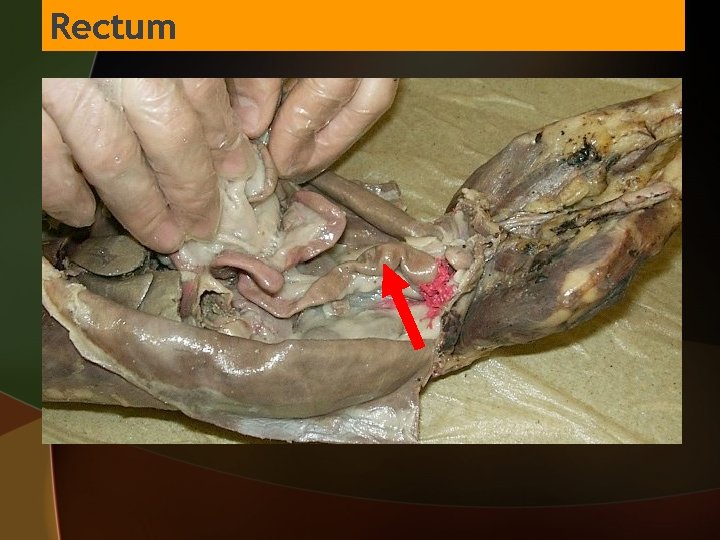 Rectum 