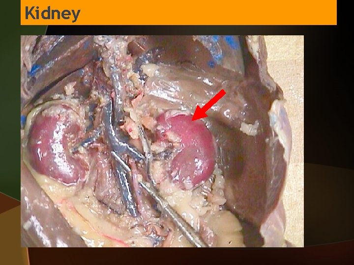 Kidney 