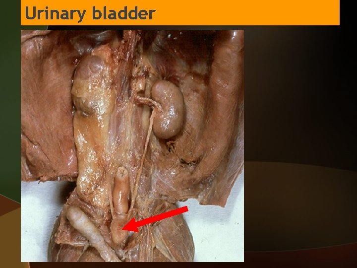 Urinary bladder 