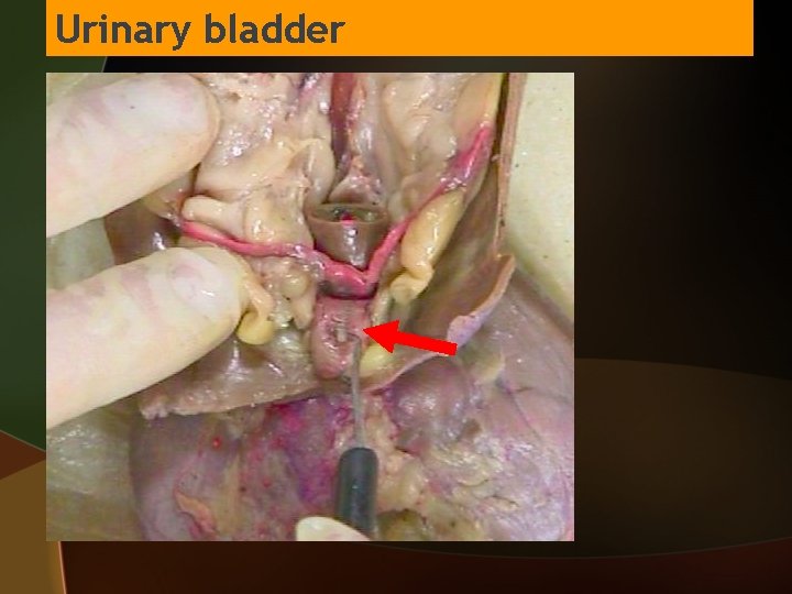 Urinary bladder 