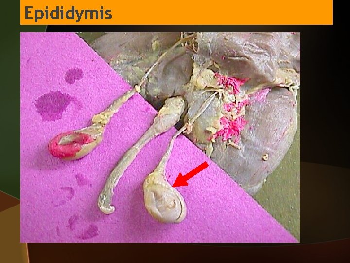 Epididymis 