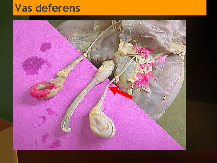 Vas deferens 