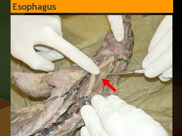 Esophagus 