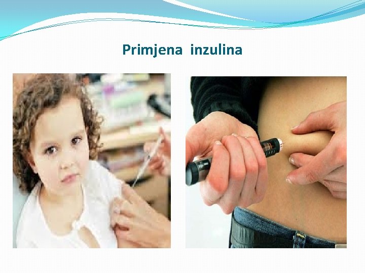 Primjena inzulina 