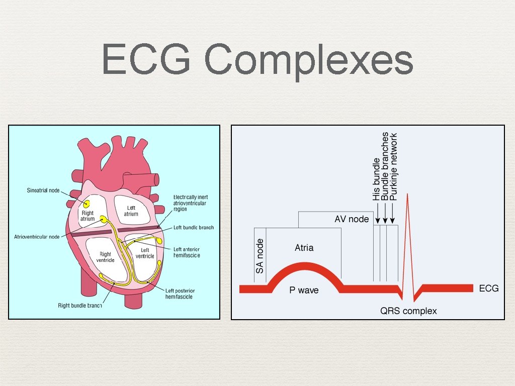 ECG Complexes 