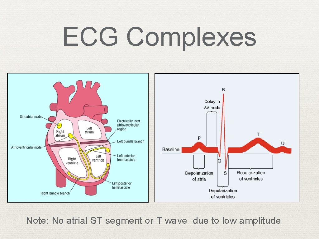ECG Complexes Note: No atrial ST segment or T wave due to low amplitude