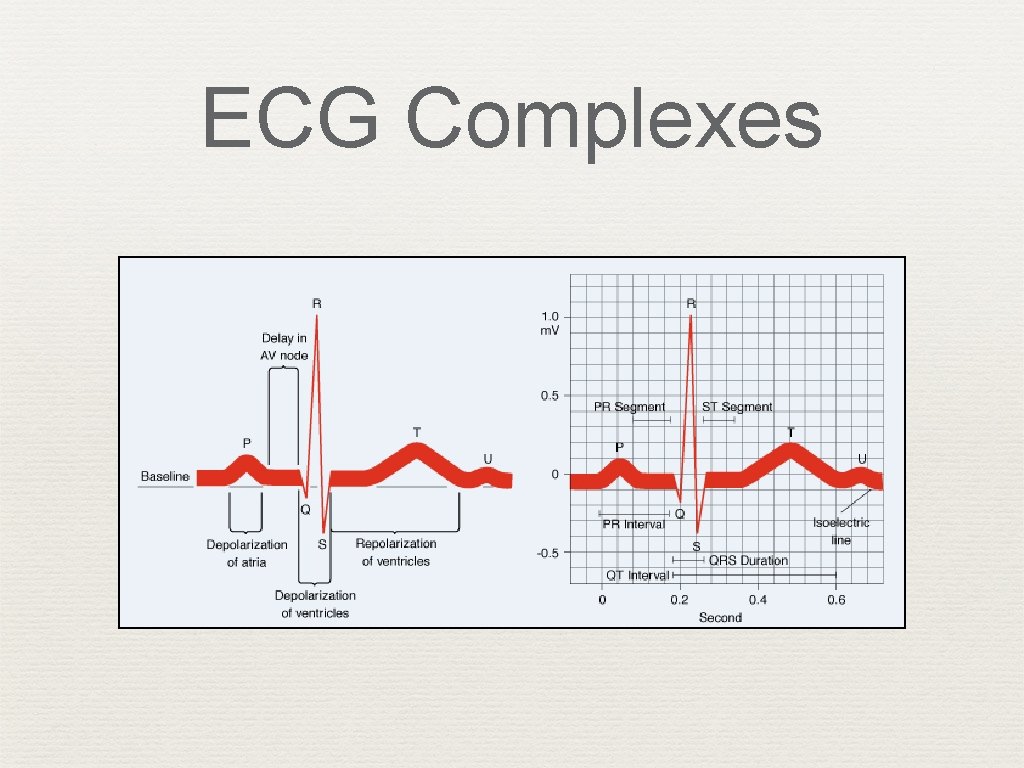 ECG Complexes 