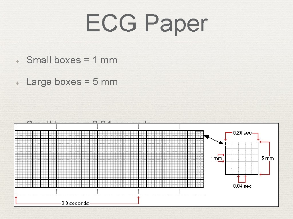 ECG Paper ✦ Small boxes = 1 mm ✦ Large boxes = 5 mm