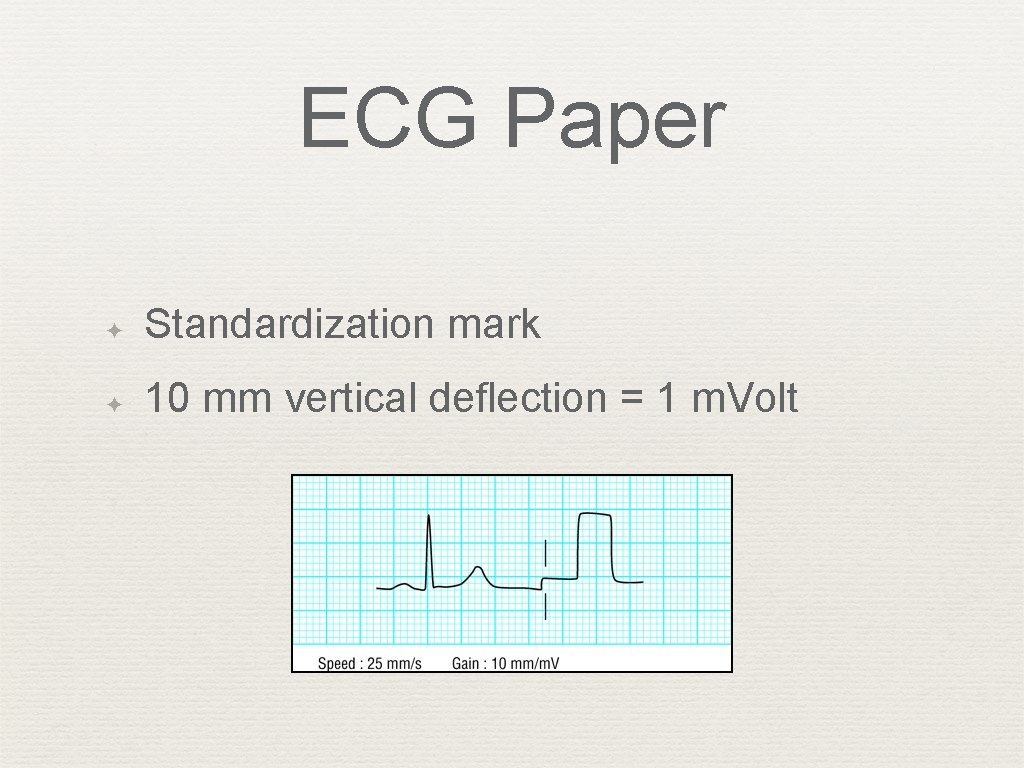 ECG Paper ✦ Standardization mark ✦ 10 mm vertical deflection = 1 m. Volt