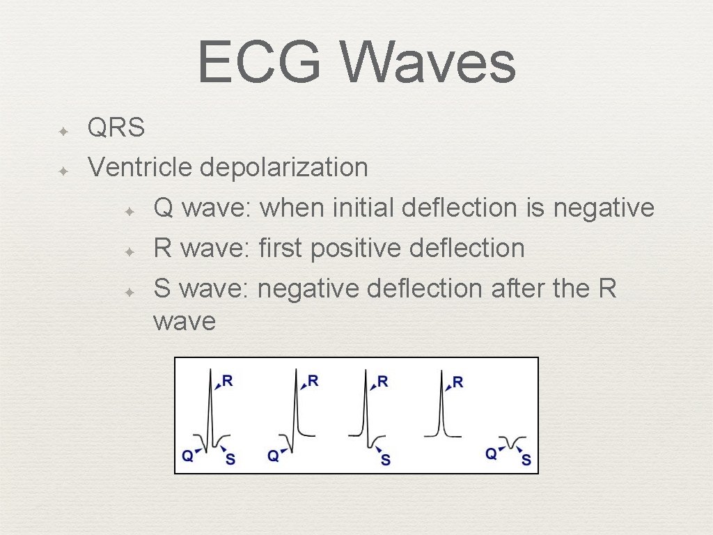 ECG Waves ✦ ✦ QRS Ventricle depolarization ✦ Q wave: when initial deflection is