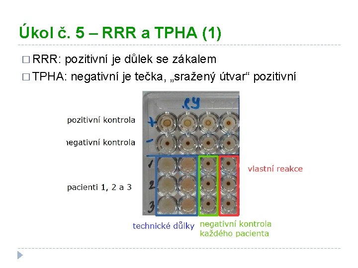 Úkol č. 5 – RRR a TPHA (1) � RRR: pozitivní je důlek se