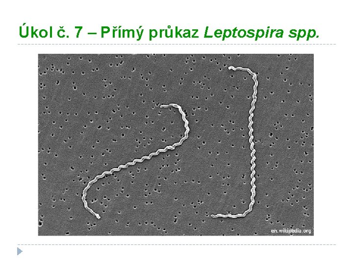 Úkol č. 7 – Přímý průkaz Leptospira spp. 