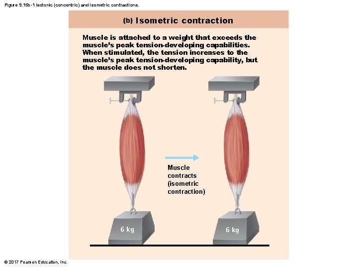 Figure 9. 15 b-1 Isotonic (concentric) and isometric contractions. Isometric contraction Muscle is attached Figure 9. 15 b-1 Isotonic (concentric) and isometric contractions. Isometric contraction Muscle is attached